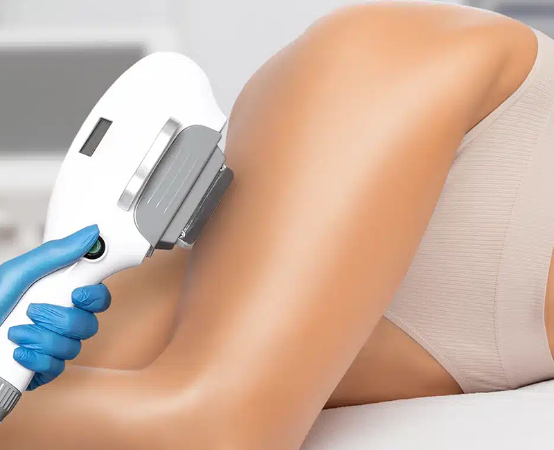 Beşiktaş Lazer epilasyon uygulama